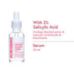 Acne Squad 2% Salicylic Acid Serum for Blackheads & Whiteheads